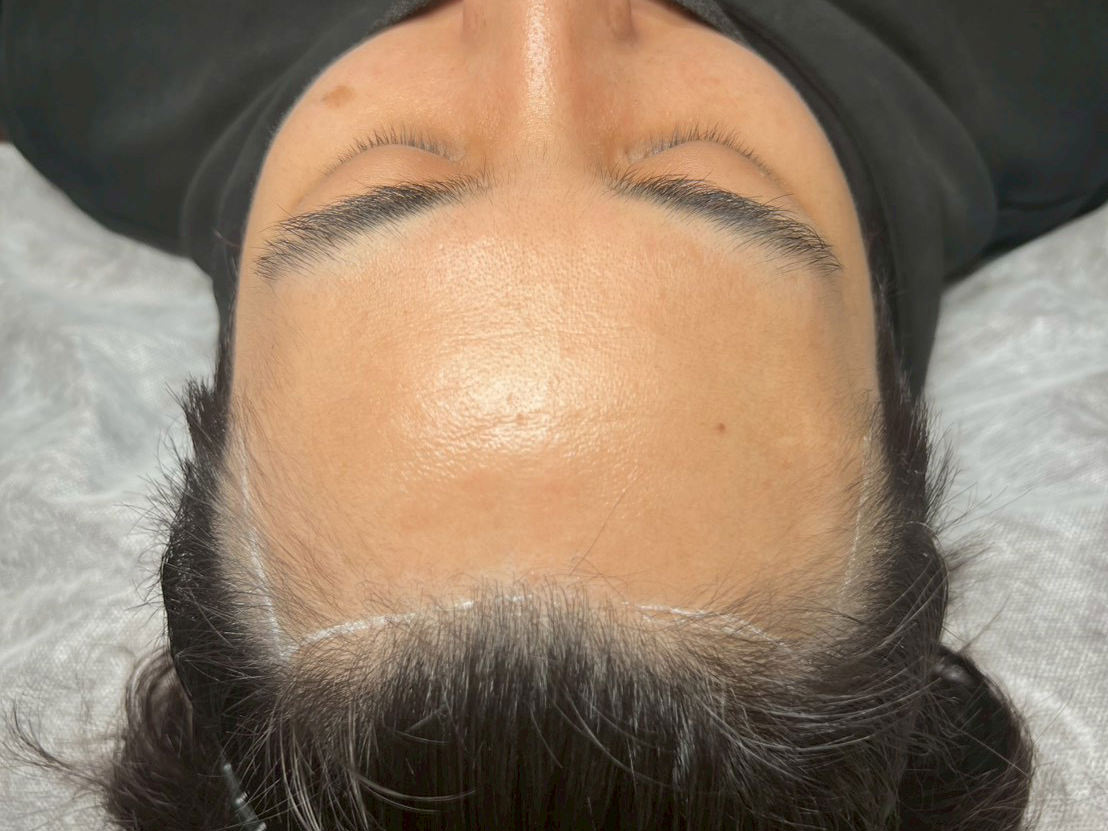 30代・男性 before
