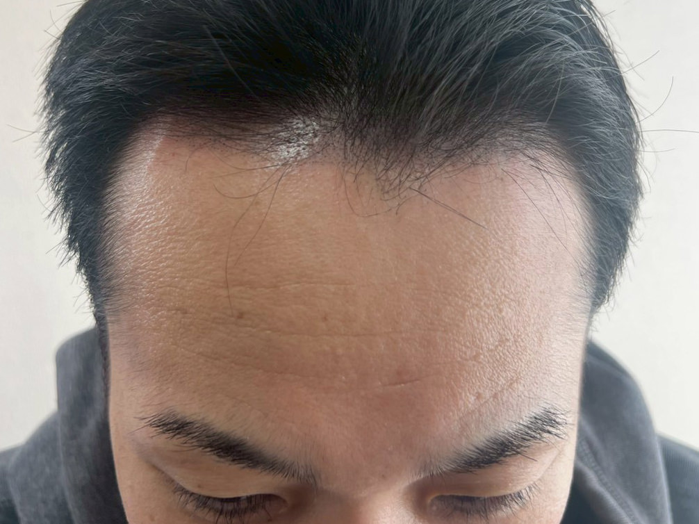 30代・男性 after