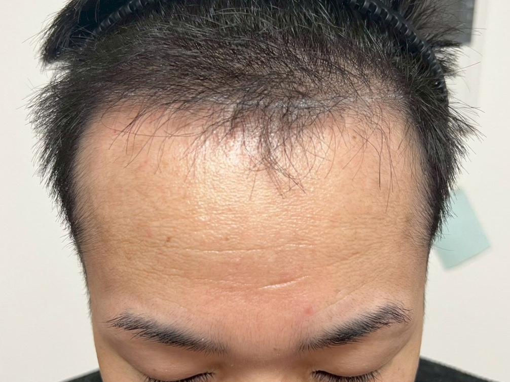 30代・男性 before