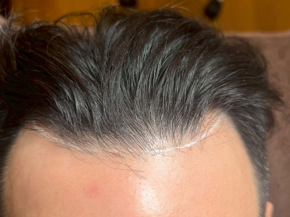 40代・男性 before