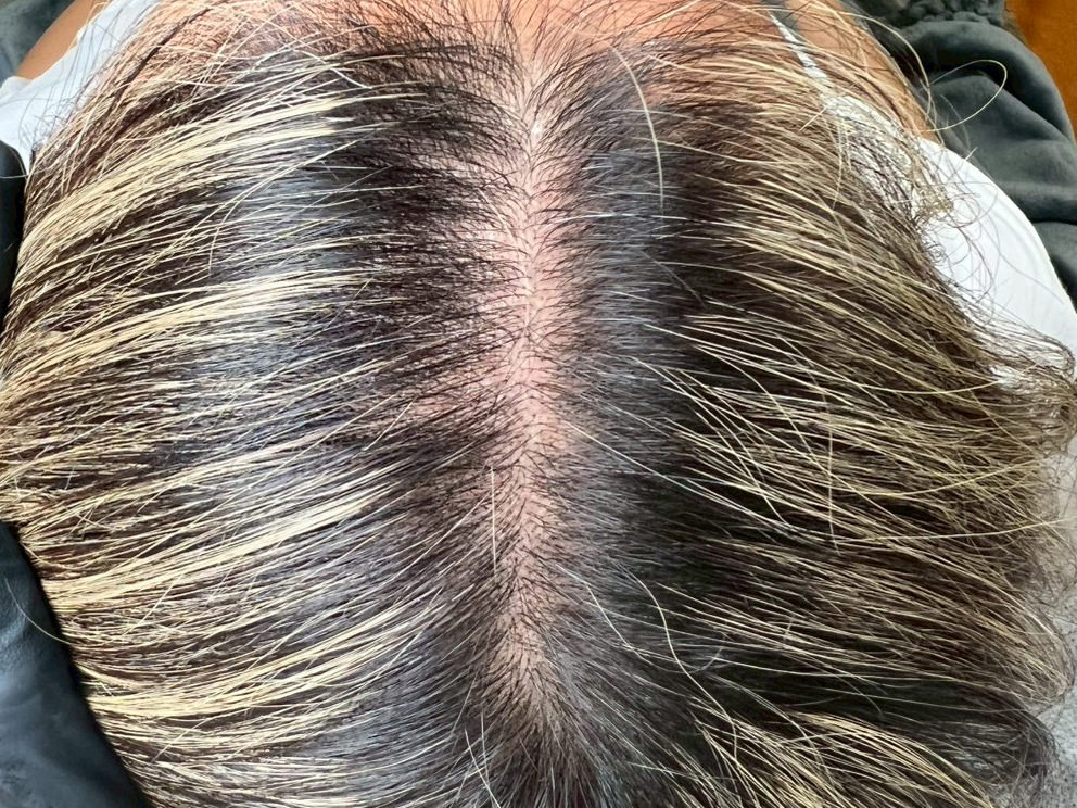 40代・男性 before