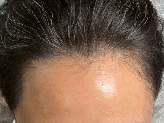 40代・男性 after