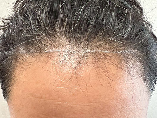 40代・男性 before
